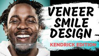 Digital Smile Design | How to Design Porcelain Veneers Digitally