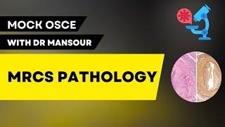 Osteomyelitis and infected implant | Pathology MOCK | MRCS part B