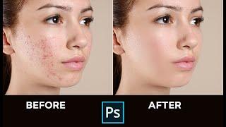 Skin Retouching; Face Smooth - Photoshop