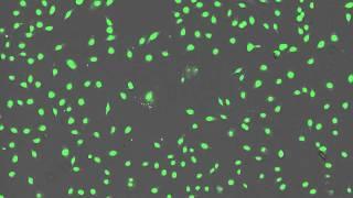 Time Lapse Imaging of BPAEC Cells Treated With Menadione