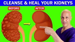 The Best Drinks to Cleanse Out the Toxins, Repair and Heal Your Kidneys!  Dr. Mandell