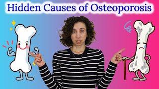 What REALLY Causes Osteoporosis (Shocking Risk Factors You Didn’t Know!)