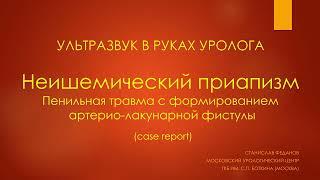 Неишемический приапизм. Ультразвук в руках уролога.