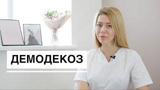 Демодекоз, подкожный клещ