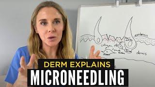 Best Way To Microneedle At Home Explained By A Dermatologist