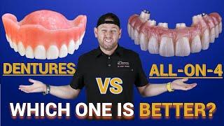 Dentures vs. Snap -in Dentures vs. ALL on 4 ®️ Bridge