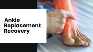 Ankle Replacement Recovery | Ankle Replacement Recovery Timeline