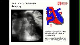 The Perfect Storm: Arrhythmia Management in Adults with Congenital Heart Disease