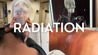 reality of radiation | what cancer radiation is really like