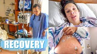 Recovering from Gall Bladder Surgery