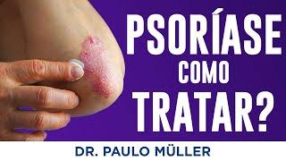 Psoríase: Causas e Tratamentos - Dr. Paulo Müller Dermatologista