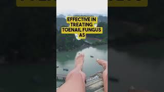 3 Easy Home Remedies for Toenail Fungus