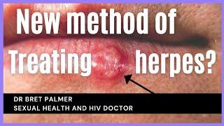 Possible new treatment for herpes?