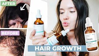 The Ordinary Multi-Peptide Serum for Hair Density Review | Before & After - 1 Year Review