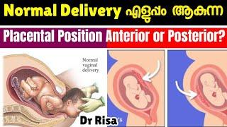 പ്രസവം എളുപ്പമാകുന്ന Placental Position? | Anterior & Posterior Placenta