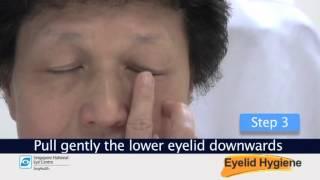 How To Clean Your Eyelid - by Singapore National Eye Centre