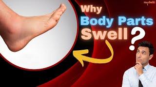 Why Body Parts Swell?