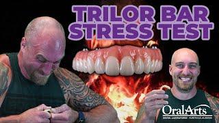 TriLor Bar  STRESS TEST! - Dental Lab Tech vs. Substructure
