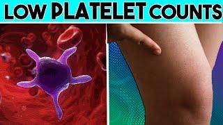 Causes, Signs and symptoms of Low platelet count |Thrombocytopenia | Low Platelet count