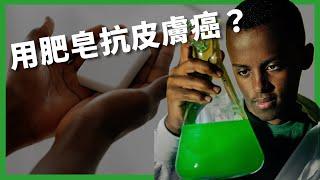 15歲少年研發「皮膚癌肥皂」！ 為什麼會有皮膚癌？ 一般人該如何預防皮膚癌？ 【TODAY 看世界｜小發明大革命】