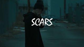 (Free) NF Type Beat - Scars
