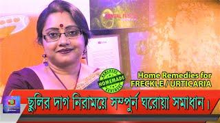 ছুলির সমস্যা হলে কি করবেন? এবং এর দাগ নিরাময়ের জন্য সম্পুর্ন ঘরোয়া সমাধান। | EP 128