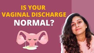 Everything about vaginal discharge| Explains Dr. Riddhima Shetty