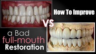 How to Improve a Bad Full-Mouth Restoration