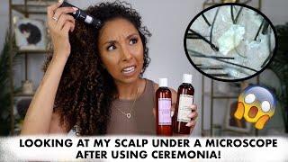 Looking at my scalp under a microscope after using CEREMONIA! Real Results! | BiancaReneeToday