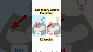 12 Week's Nub theory Gender Reveal ultrasound scan