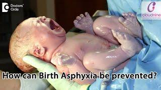 How can Birth Asphyxia be prevented? - Dr. Piyush Shah of Cloudnine Hospitals | Doctors’ Circle