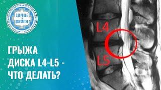 ⭕  Грыжа диска L4-L5 - что делать?