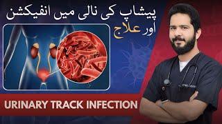 Urinary Trck Infection || Symptoms,Treatment || Dr Bandesha