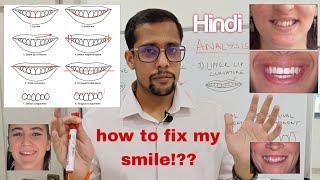 स्माइल को कैसे सुधारे in 5 mins || अपनी स्माइल करेक्ट करें | smile Analysis