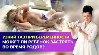 УЗКИЙ ТАЗ ПРИ БЕРЕМЕННОСТИ. Может ли ребенок застрять во время родов?