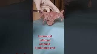Uterus specimen demonstration - with Chimmalgi