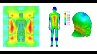 SAR simulation on MRI system with ANSYS HFSS