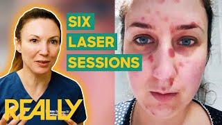 Dr. Emma Addresses a Patient's Irritating Skin Condition | The Bad Skin Clinic