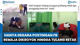 Hanya Gegara Postingan FB, Remaja Perempuan di Palu Dikeroyok Hingga Tulang Retak