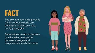 Endometriosis Myths vs. Facts | Merck Manual Consumer Version