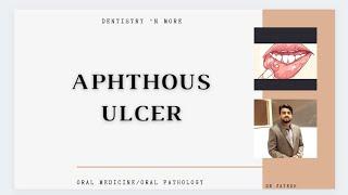 APHTHOUS ULCER