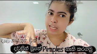 දෑලි ගාගෙන එක දවසින්  මූනේ Pimples නෑති කරගමූ  | Pimples removal on face at home  | Day Vlog ️