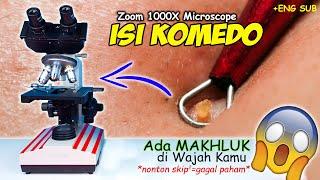 INILAH MAKHLUK HALUS DI KOMEDO WAJAH KITA | Demodex Face Mites Microscope Zoom 1000X