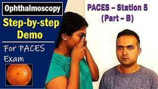 PACES UK Station -5 Ophthalmoscopy/Fundus Exam Step-by-step How-to Guide