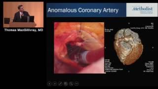 Advances in Surgical Treatment of CHD (Thomas MacGillivray, MD)