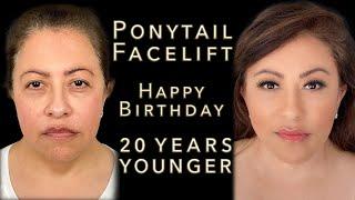 She Got Ponytail Facelift For Her Birthday! - KaoEyes, Jowl Lift, Neck Lift - Amazing Birthday Gift!