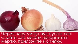 Как убрать синяки под глазами в домашних условиях