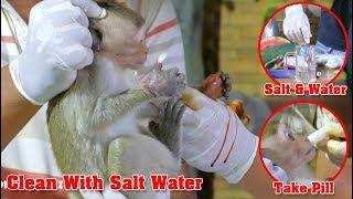 VO's Start Cleaning Janet Hands By Using Salt & Hot Water That Can Help More Dry Her Hand - MB 529