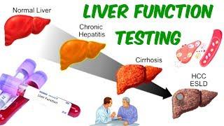 LIVER FUNCTION TESTING! - AST, ALT, and ALP- Is your liver in SERIOUS TROUBLE?