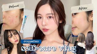 🪞 self-care vlog. how to glow up/get rid of acne/filler injection/find your own style! | Babyjingko